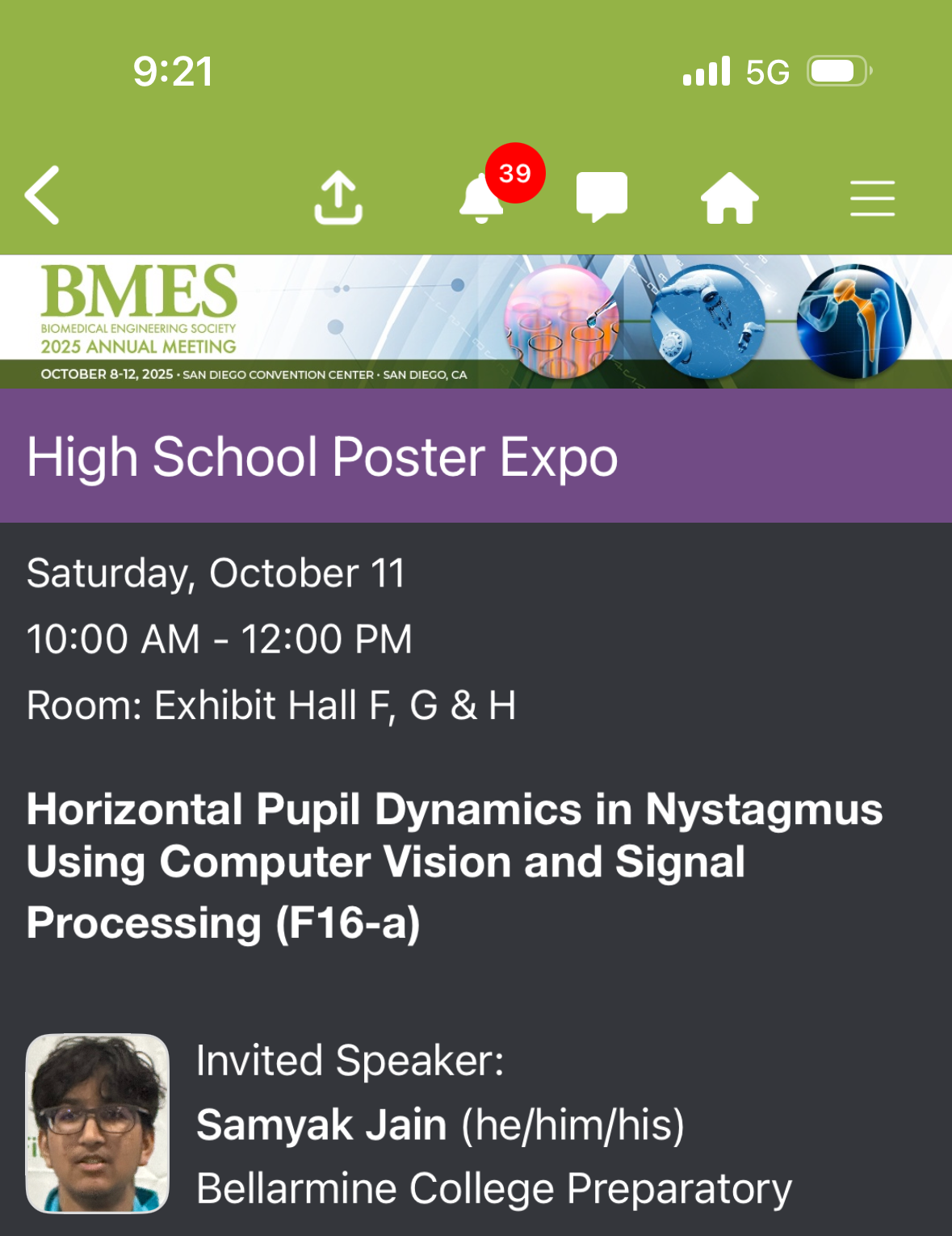 Nystagmus Diagnostics computer vision analysis